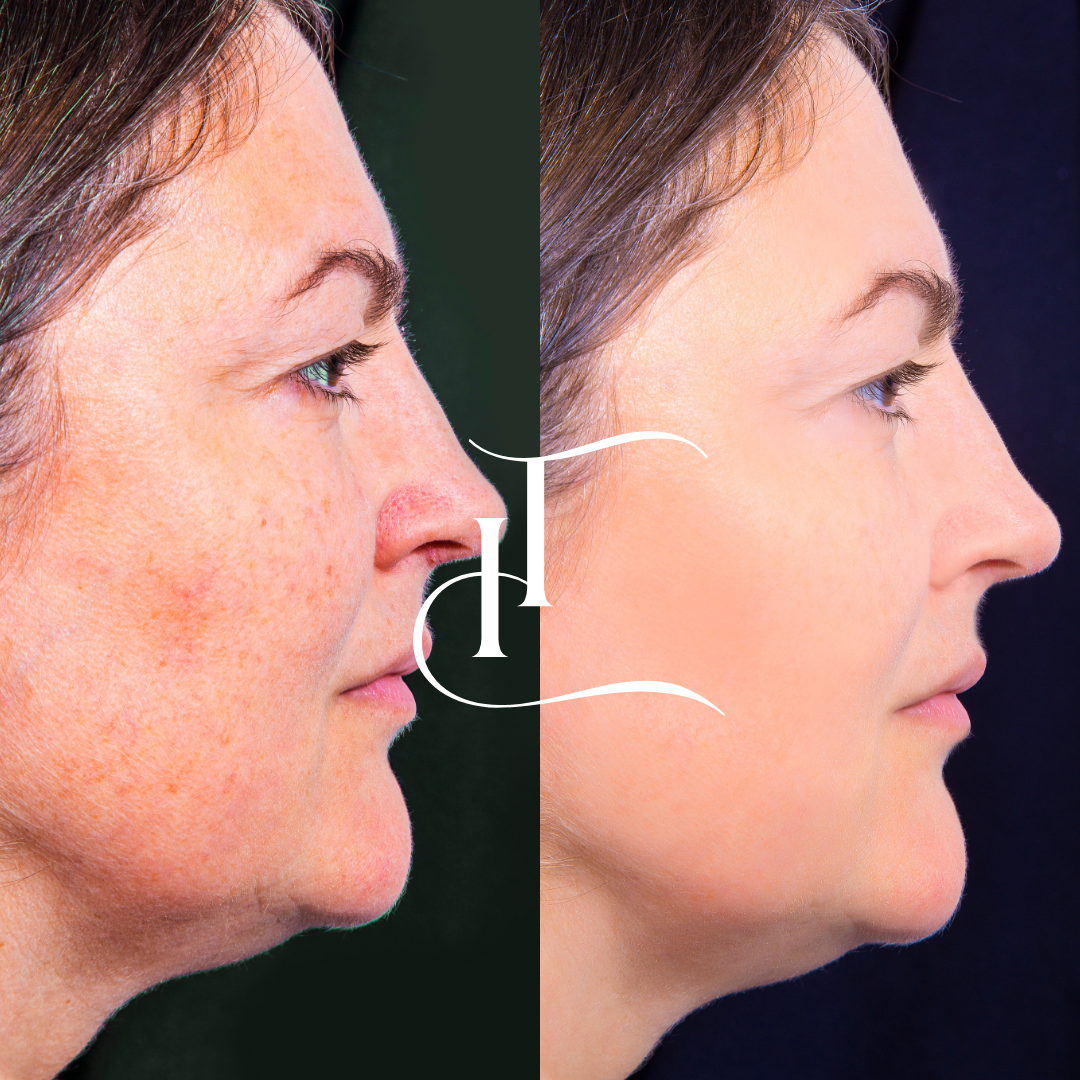 imgi_15_Especialista-em-Harmonizacao-Facial-19