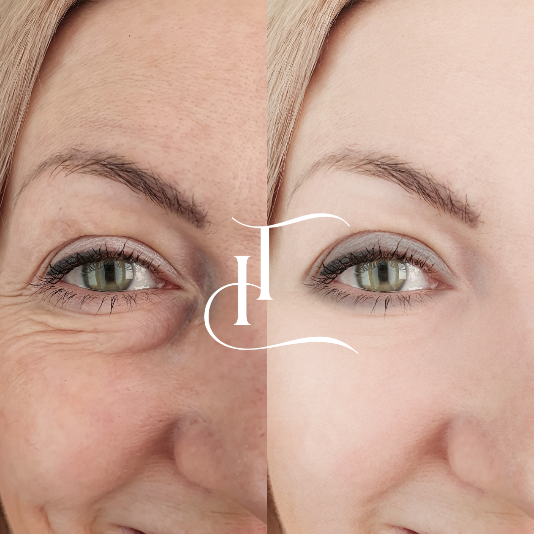 imgi_18_Especialista-em-Harmonizacao-Facial-2-1