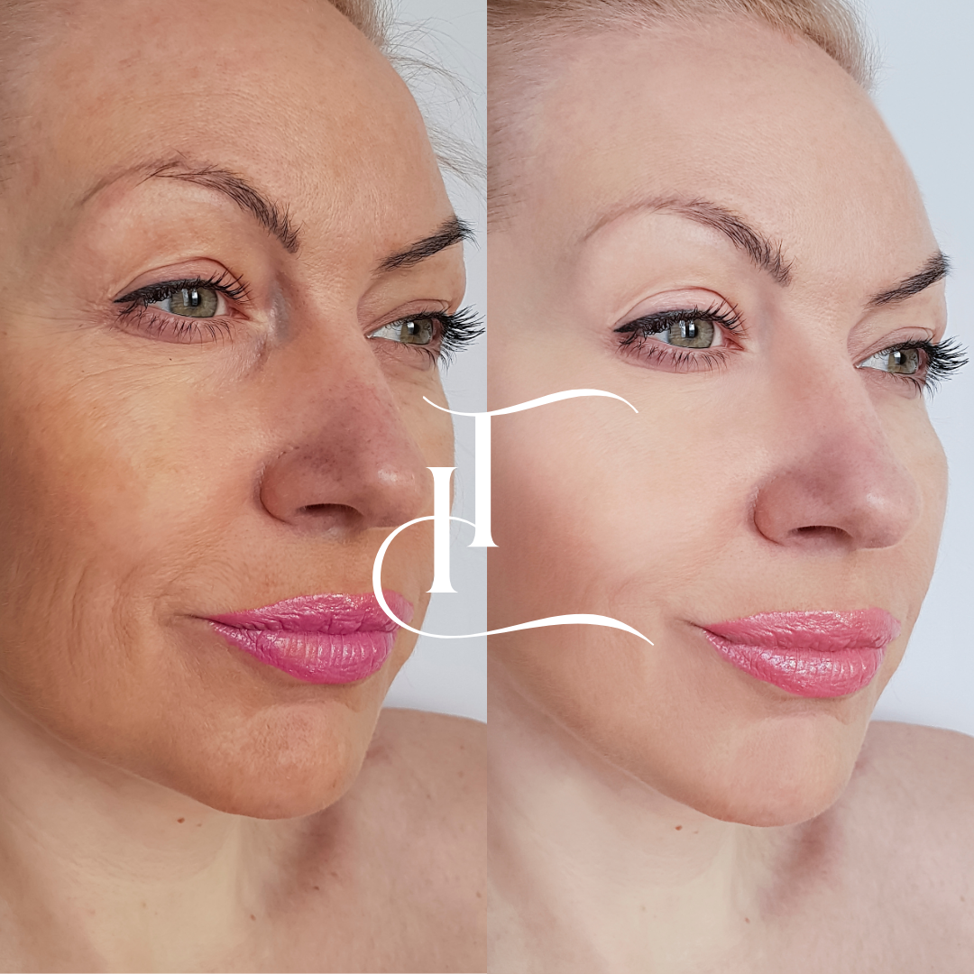 imgi_21_Especialista-em-Harmonizacao-Facial-6-1