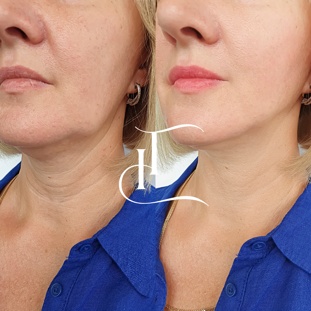 imgi_22_Especialista-em-Harmonizacao-Facial-5-1